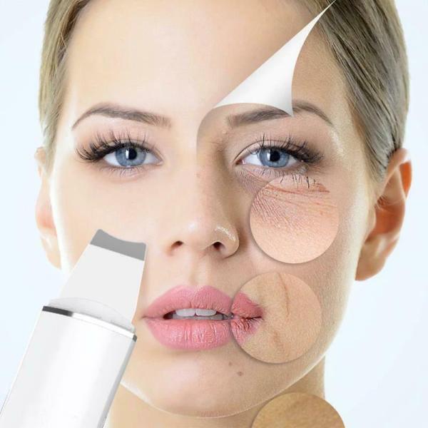 Scrubber Viso a Ultrasuoni